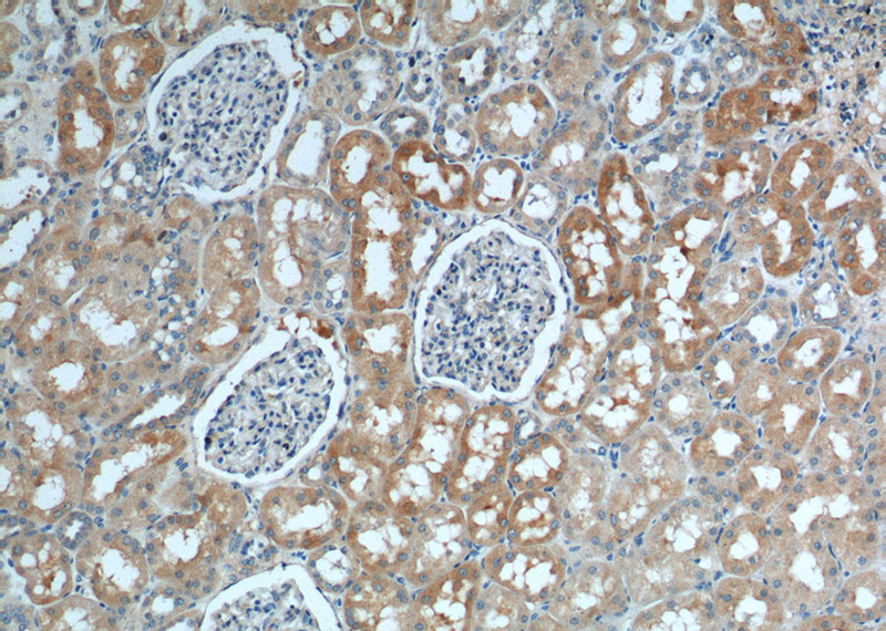 Immunohistochemistry of paraffin-embedded human kidney tissue slide using Catalog No:115340(SLC4A1AP Antibody) at dilution of 1:200 (under 10x lens).