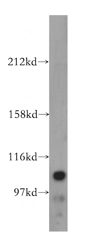 mouse kidney tissue were subjected to SDS PAGE followed by western blot with Catalog No:110792(FUK antibody) at dilution of 1:500