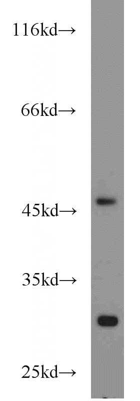 mouse heart tissue were subjected to SDS PAGE followed by western blot with Catalog No:113626(PDK3 antibody) at dilution of 1:1000