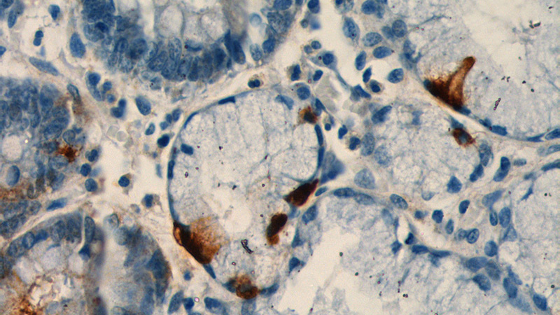 Immunohistochemistry of paraffin-embedded human stomach tissue slide using (GAST Antibody) at dilution of 1:1000 (under 40x lens).