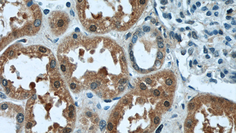 Immunohistochemistry of paraffin-embedded human kidney tissue slide using Catalog No:112407(LYN Antibody) at dilution of 1:50 (under 40x lens)
