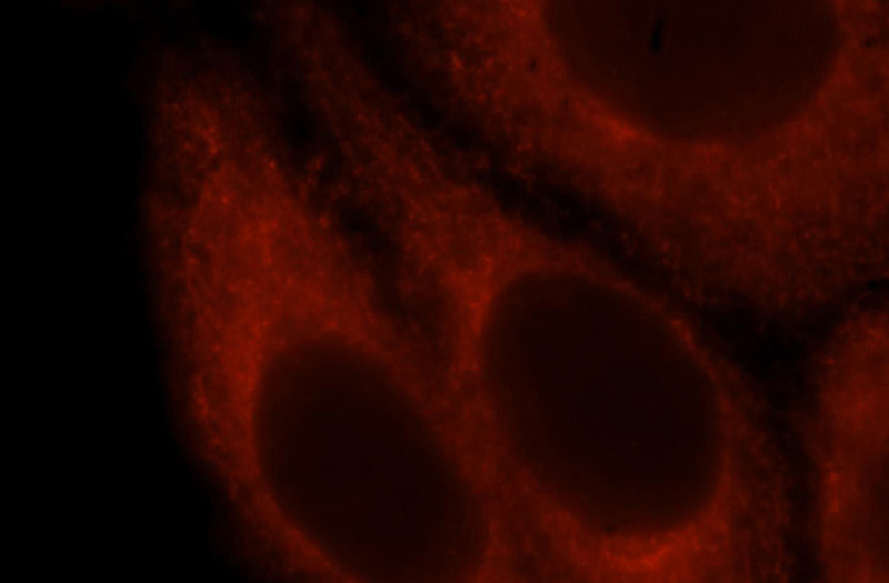 Immunofluorescent analysis of HepG2 cells, using MSN antibody Catalog No:112726 at 1:25 dilution and Rhodamine-labeled goat anti-rabbit IgG (red).