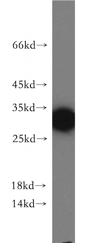 HepG2 cells were subjected to SDS PAGE followed by western blot with Catalog No:108710(CTA-216E10.6 antibody) at dilution of 1:500
