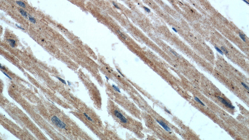 Immunohistochemical of paraffin-embedded human heart using Catalog No:117087(B3GALT2 antibody) at dilution of 1:50 (under 40x lens)
