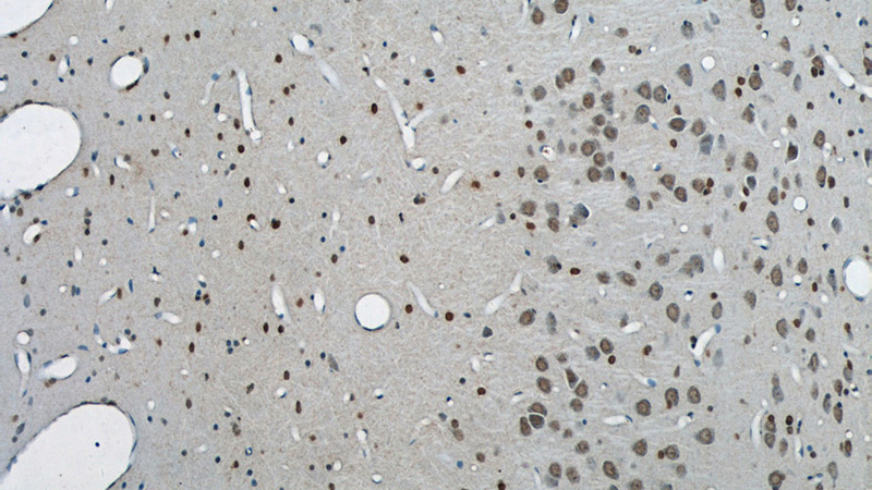 Immunohistochemical of paraffin-embedded rat brain using Catalog No:117225(BRCA2 antibody) at dilution of 1:50 (under 10x lens)