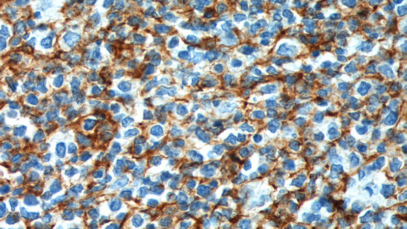 Immunohistochemistry of paraffin-embedded human tonsillitis tissue slide using Catalog No:109008(CR2 Antibody) at dilution of 1:200 (under 40x lens). heat mediated antigen retrieved with Tris-EDTA buffer(pH9).