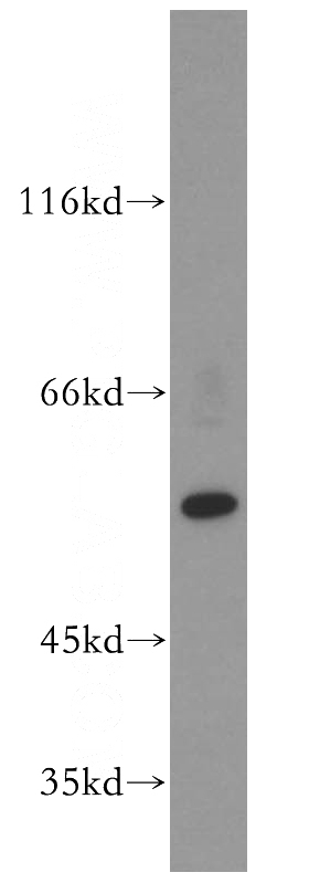 U-937 cells were subjected to SDS PAGE followed by western blot with Catalog No:114081(PPARG antibody) at dilution of 1:800