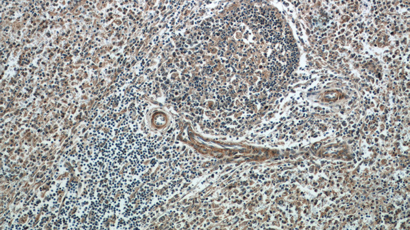 Immunohistochemistry of paraffin-embedded human spleen tissue slide using Catalog No:111344(TGFB1I1 Antibody) at dilution of 1:50 (under 10x lens)