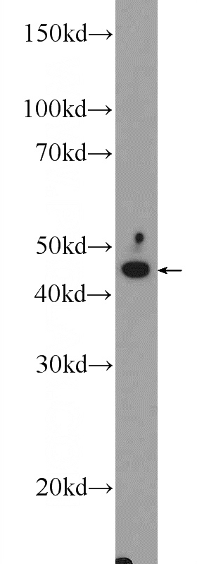 fetal human brain tissue were subjected to SDS PAGE followed by western blot with Catalog No:110668(FJX1 Antibody) at dilution of 1:300