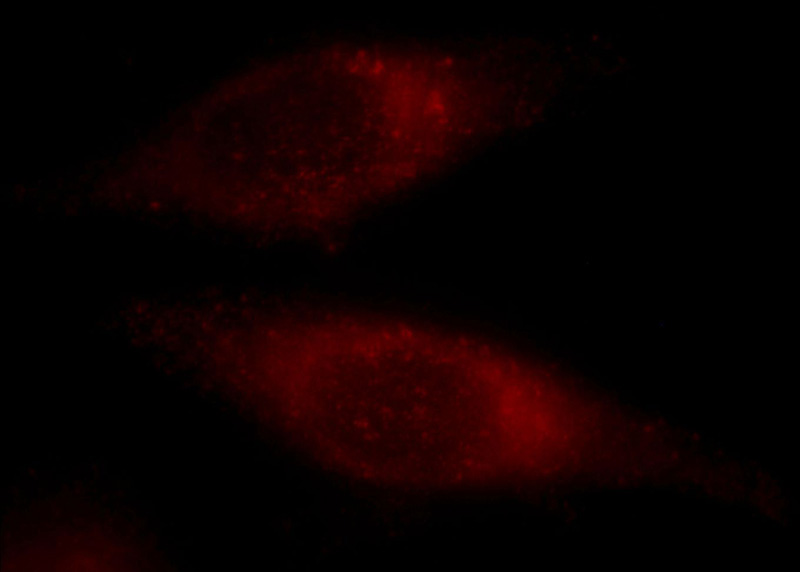 Immunofluorescent analysis of Hela cells, using CNOT3 antibody Catalog No:109434 at 1:25 dilution and Rhodamine-labeled goat anti-rabbit IgG (red).