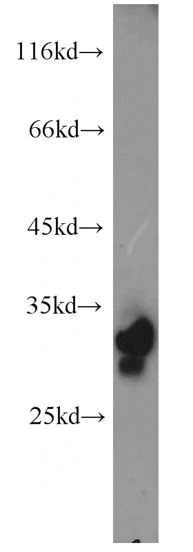 human liver tissue were subjected to SDS PAGE followed by western blot with Catalog No:113865(PHYHD1 antibody) at dilution of 1:800