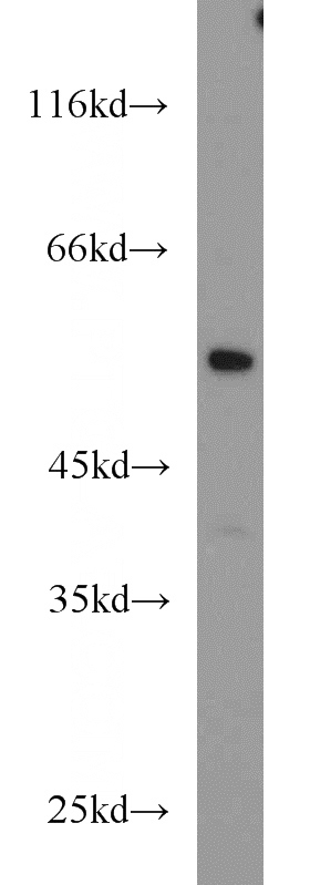 mouse ovary tissue were subjected to SDS PAGE followed by western blot with Catalog No:113269(NR5A1 antibody) at dilution of 1:1000