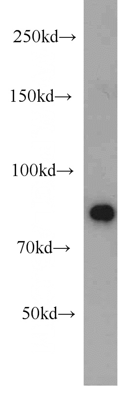 HeLa cells were subjected to SDS PAGE followed by western blot with Catalog No:115695(STAT6 antibody) at dilution of 1:1000