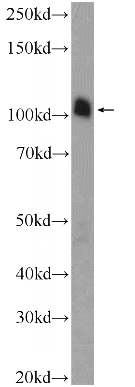 mouse testis tissue were subjected to SDS PAGE followed by western blot with Catalog No:108334(ATN1 Antibody) at dilution of 1:300