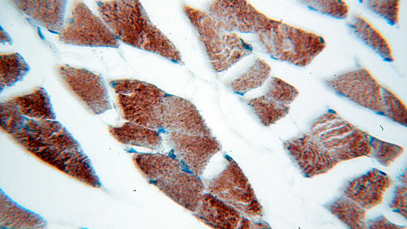 Immunohistochemical of paraffin-embedded human skeletal muscle using Catalog No:112687(MLXIP antibody) at dilution of 1:100 (under 40x lens)