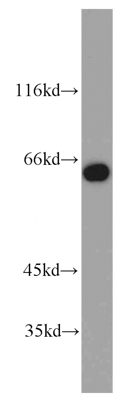 HeLa cells were subjected to SDS PAGE followed by western blot with Catalog No:114336(PUF60 antibody) at dilution of 1:800