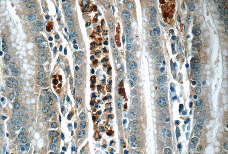 Immunohistochemistry of paraffin-embedded human stomach tissue slide using Catalog No:108147(ARL8B Antibody) at dilution of 1:50 (under 40x lens)