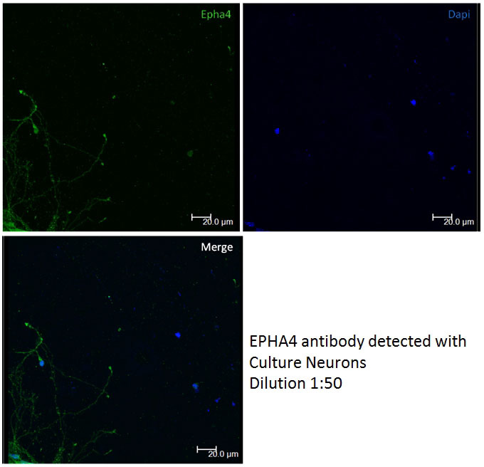 IF result of EPHA4 antibody (Catalog No:110349, 1:50) with culture neuron cells by Wilson Pak Kin Lou.