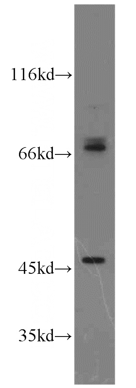 MCF7 cells were subjected to SDS PAGE followed by western blot with Catalog No:113881(PIAS2 antibody) at dilution of 1:2000