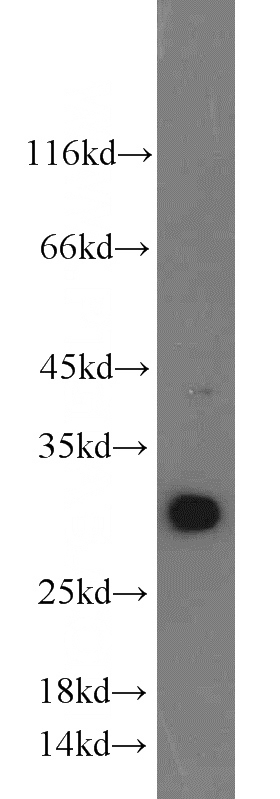 mouse kidney tissue were subjected to SDS PAGE followed by western blot with Catalog No:110247(ENDOG antibody) at dilution of 1:1000