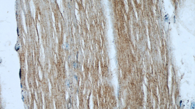 Immunohistochemical of paraffin-embedded human skeletal muscle using Catalog No:115272(SHF antibody) at dilution of 1:50 (under 40x lens)