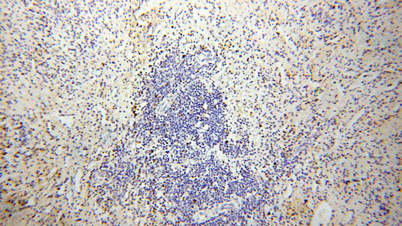 Immunohistochemical of paraffin-embedded human spleen using Catalog No:110077(LIG1 antibody) at dilution of 1:100 (under 10x lens)