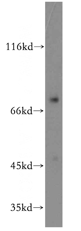 HEK-293 cells were subjected to SDS PAGE followed by western blot with Catalog No:111733(IL2RB antibody) at dilution of 1:100