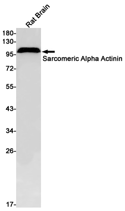Western blot detection of Sarcomeric Alpha Actinin in Rat Brain lysates using Sarcomeric Alpha Actinin Rabbit pAb(1:1000 diluted).Predicted band size:104kDa.Observed band size:104kDa.
