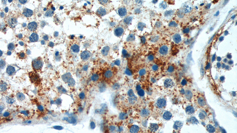 Immunohistochemistry of paraffin-embedded human testis tissue slide using Catalog No:115497(SOHLH1 Antibody) at dilution of 1:100 (under 40x lens).