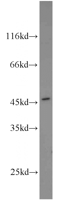 human brain tissue were subjected to SDS PAGE followed by western blot with Catalog No:113592(PARP2 antibody) at dilution of 1:800
