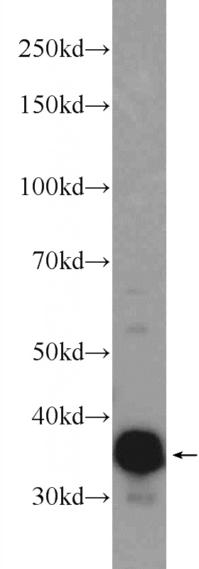 rat skeletal muscle tissue were subjected to SDS PAGE followed by western blot with Catalog No:116155(TNNT3 Antibody) at dilution of 1:1000