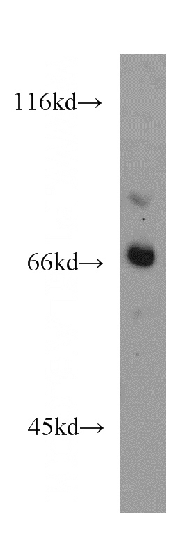HeLa cells were subjected to SDS PAGE followed by western blot with Catalog No:109194(CES3 antibody) at dilution of 1:500