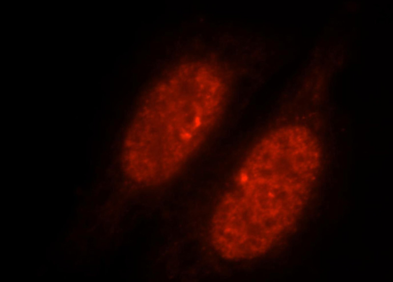 Immunofluorescent analysis of HepG2 cells, using SLTM antibody Catalog No:115412 at 1:25 dilution and Rhodamine-labeled goat anti-rabbit IgG (red).
