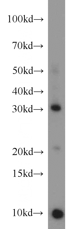 mouse small intestine tissue were subjected to SDS PAGE followed by western blot with Catalog No:109057(CD40LG antibody) at dilution of 1:1000