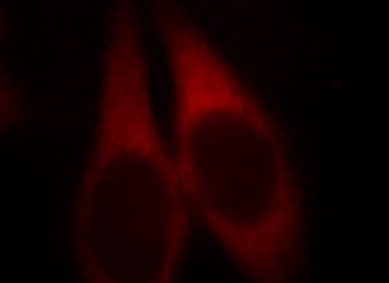 Immunofluorescent analysis of MCF-7 cells, using EEF1D antibody Catalog No: at 1:25 dilution and Rhodamine-labeled goat anti-mouse IgG (red).