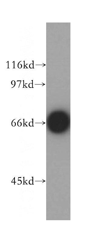 mouse testis tissue were subjected to SDS PAGE followed by western blot with Catalog No:115930(TDRKH antibody) at dilution of 1:500