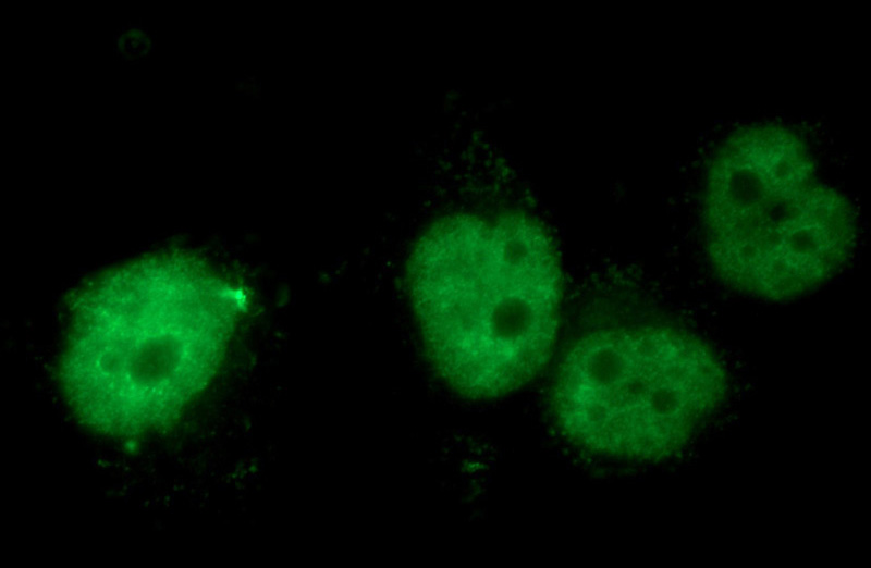 Immunofluorescent analysis of HeLa cells using Catalog No:108946(CBX4 Antibody) at dilution of 1:50 and Alexa Fluor 488-congugated AffiniPure Goat Anti-Rabbit IgG(H+L)