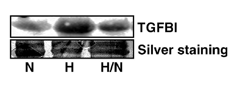 WB detection of anti-TGFBI in the extracellularmedia of LEC grown for 24 h under normoxia (N), hypoxia (H) or hypoxia and reoxygenation (H/N) for 6 h. One result representative of at least three different experiments is shown. Silver staining of the membranes was used as loading control. (From PMID:18560760; Irigoyen M, et al, TGFbeta-induced protein mediates lymphatic endothelial cell adhesion to the extracellular matrix under low oxygen conditions, Cell Mol Life Sci. 65(14), 2244-55, 2008)