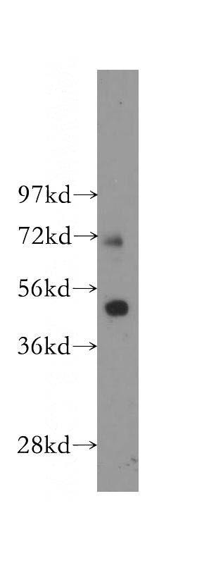 human colon tissue were subjected to SDS PAGE followed by western blot with Catalog No:110533(SLC27A4 antibody) at dilution of 1:300
