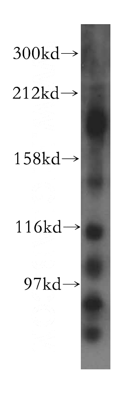 mouse brain tissue were subjected to SDS PAGE followed by western blot with Catalog No:112001(KIF17 antibody) at dilution of 1:1000
