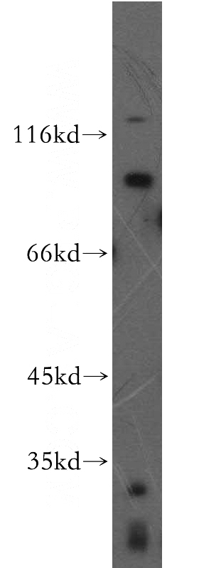 A549 cells were subjected to SDS PAGE followed by western blot with Catalog No:110642(FGFR2 antibody) at dilution of 1:300