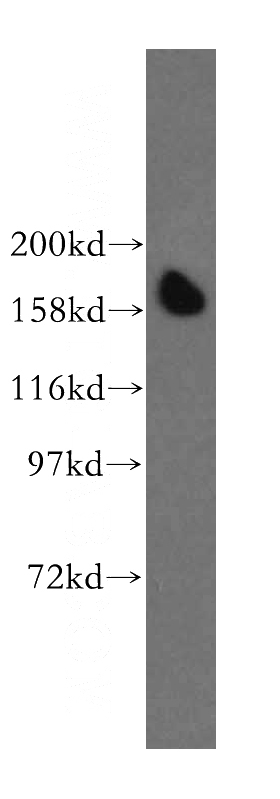 A431 cells were subjected to SDS PAGE followed by western blot with Catalog No:110216(EGFR antibody) at dilution of 1:800
