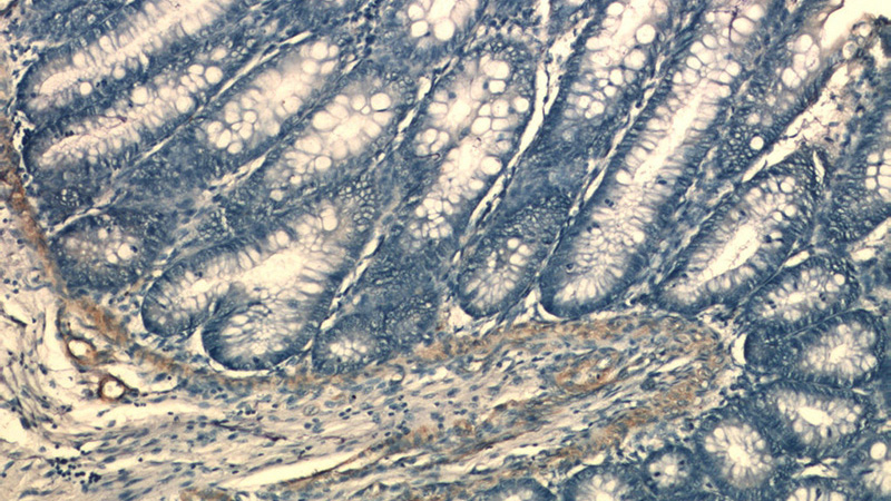 Immunohistochemistry of paraffin-embedded human colon tissue slide using Catalog No:115286(SIDT1 Antibody) at dilution of 1:50 (under 10x lens)