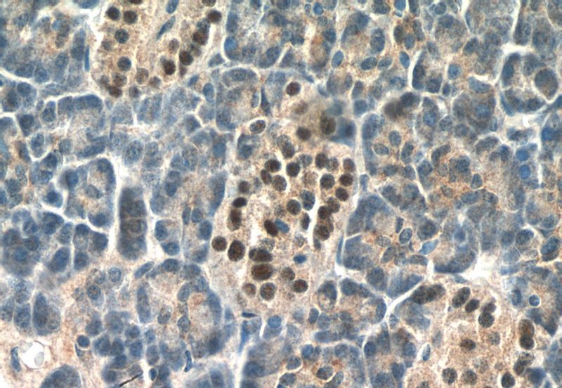 Immunohistochemistry of paraffin-embedded human pancreas tissue slide using Catalog No:111941(Islet 1 Antibody) at dilution of 1:200 (under 40x lens)
