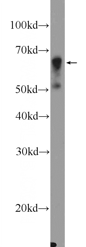 A549 cells were subjected to SDS PAGE followed by western blot with Catalog No:113483(PADI4 Antibody) at dilution of 1:600