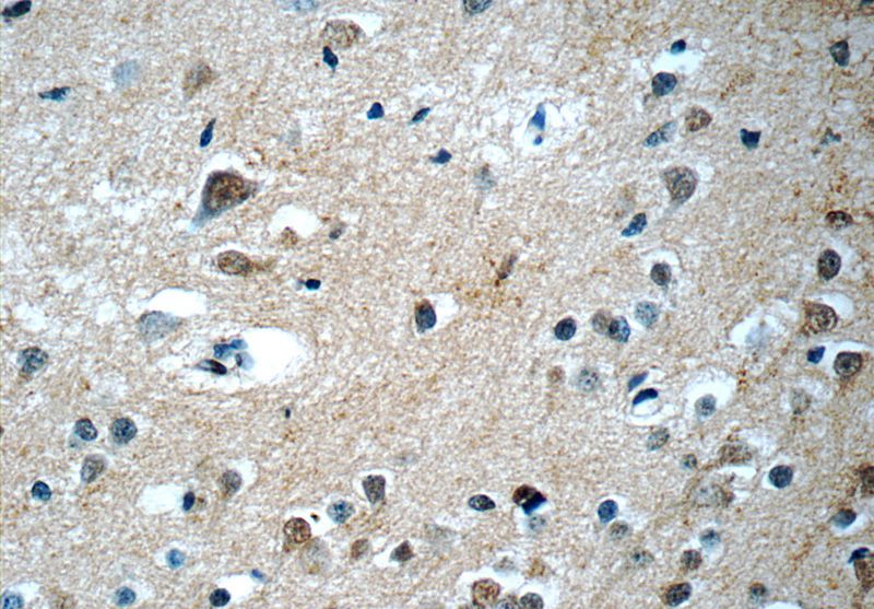 Immunohistochemistry of paraffin-embedded human brain tissue slide using Catalog No:114929(RRP7A Antibody) at dilution of 1:50 (under 40x lens)