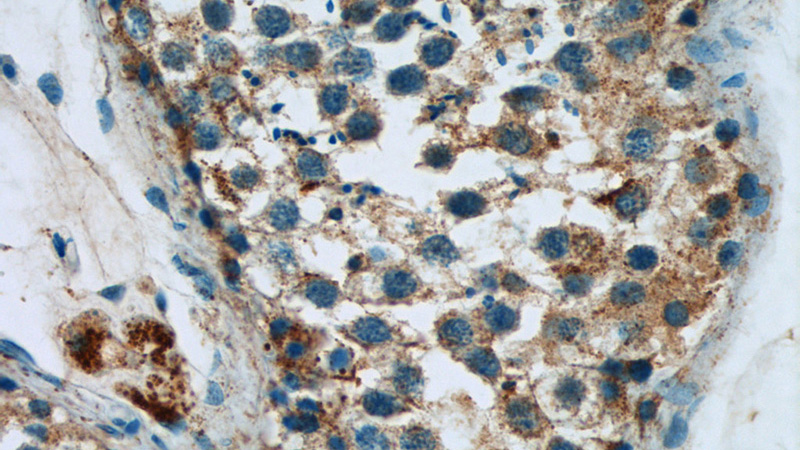 Immunohistochemistry of paraffin-embedded human testis tissue slide using Catalog No:111578(HYAL4 Antibody) at dilution of 1:50 (under 40x lens)