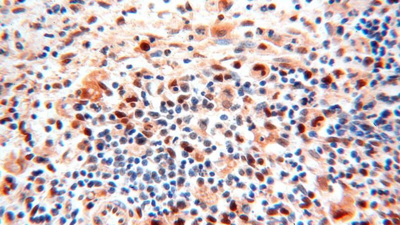 Immunohistochemical of paraffin-embedded human spleen using Catalog No:110507(EXOSC10 antibody) at dilution of 1:50 (under 40x lens)