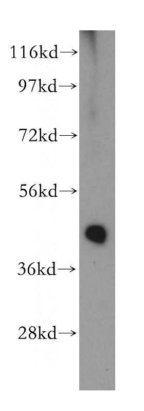 human adrenal gland tissue were subjected to SDS PAGE followed by western blot with Catalog No:111552(HSD3B2 antibody) at dilution of 1:1500