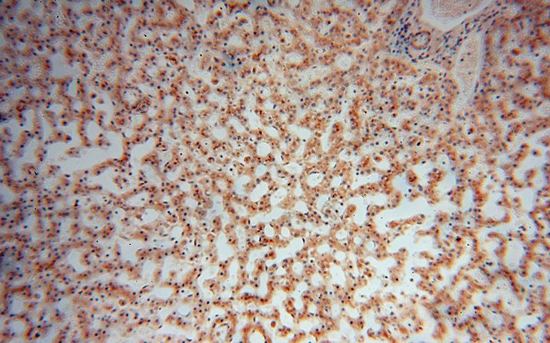 Immunohistochemical of paraffin-embedded human liver using Catalog No:113632(PDLIM7 antibody) at dilution of 1:100 (under 10x lens)